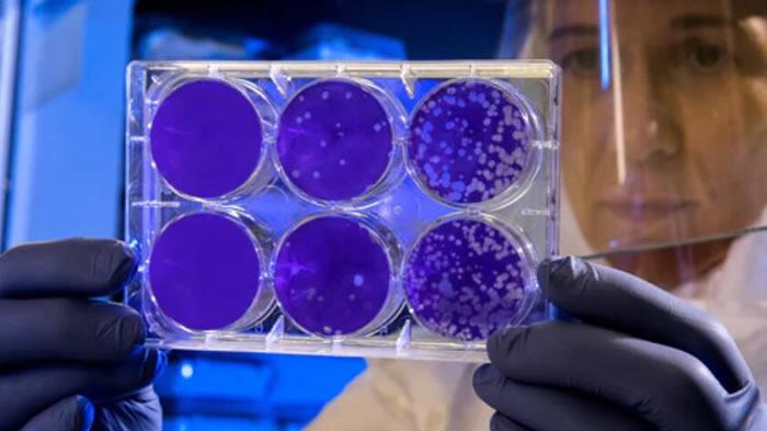 科学家 硅谷Altos Labs的新冒险：通过细胞重编程让人类寿命延长50年