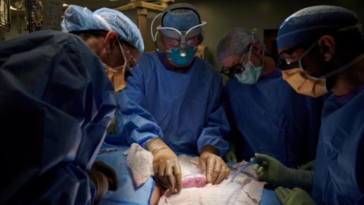 科学突破：把猪的肾脏移植给人，美国医生成功了，但只维持了3天