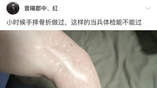 搞笑神回复|神回复：小时候手摔骨折过，这样的当兵体检可以通过吗？哈哈哈！