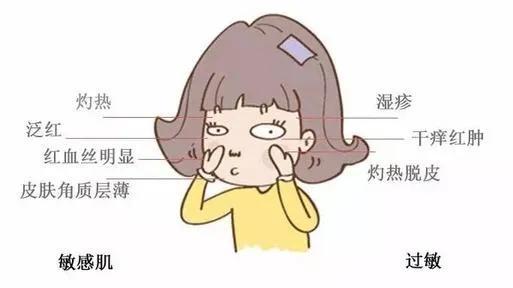 敏感肌肤|过敏和敏感肌肤如何区分