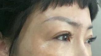 防晒|黄褐斑怎样才能彻底的去掉？15天变素颜女神，从此告别美颜相机！