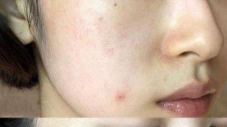 口红 长期使用精华液，三年后肌肤将变成什么样子？说出来你可能不信