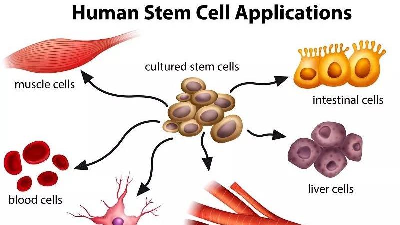 盘点：干细胞疗法在不同疾病的临床研究及应用