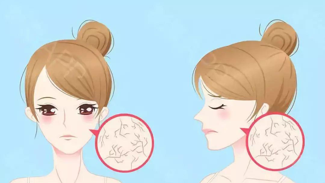 面膜 皮肤敏感易干燥？换季护肤要避开3个“误区”，不然等于白费功夫！