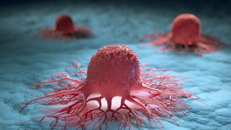 黑色素瘤 Science重磅：科学家找到癌症发生源头，治愈肿瘤有了新思路