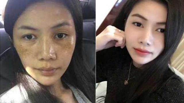 |脸上长“色斑”不必慌，药店这款平价“精华液”，美白淡斑还嫩肤