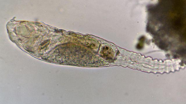 丹阳 2.4万年前的微生物被“复活”，科学家表示，或帮人类实现永生！