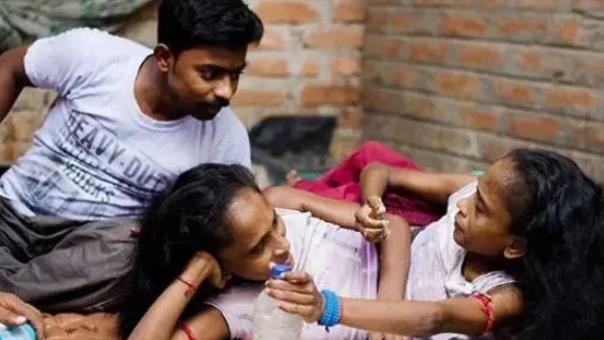 印度连体姐妹共用下肢，嫁给同一位男子，生下的孩子怎么样了？