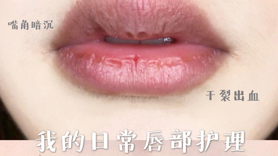 唇膏 小蓝罐有“毒”？雅顿过敏得唇炎？孕期唇膏哪家强？宝妈带你排雷