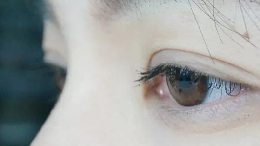 木耳|眼修复孙沣博士：那眼眸倾泻一汪柔情，如一池清澈的湖水