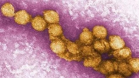 何沐青谈|?西藏发现1万5千年前的“病毒”，病毒释放，会威胁人类吗