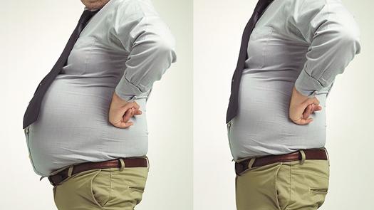 疾病 有肥胖朋友的一定要进来看看