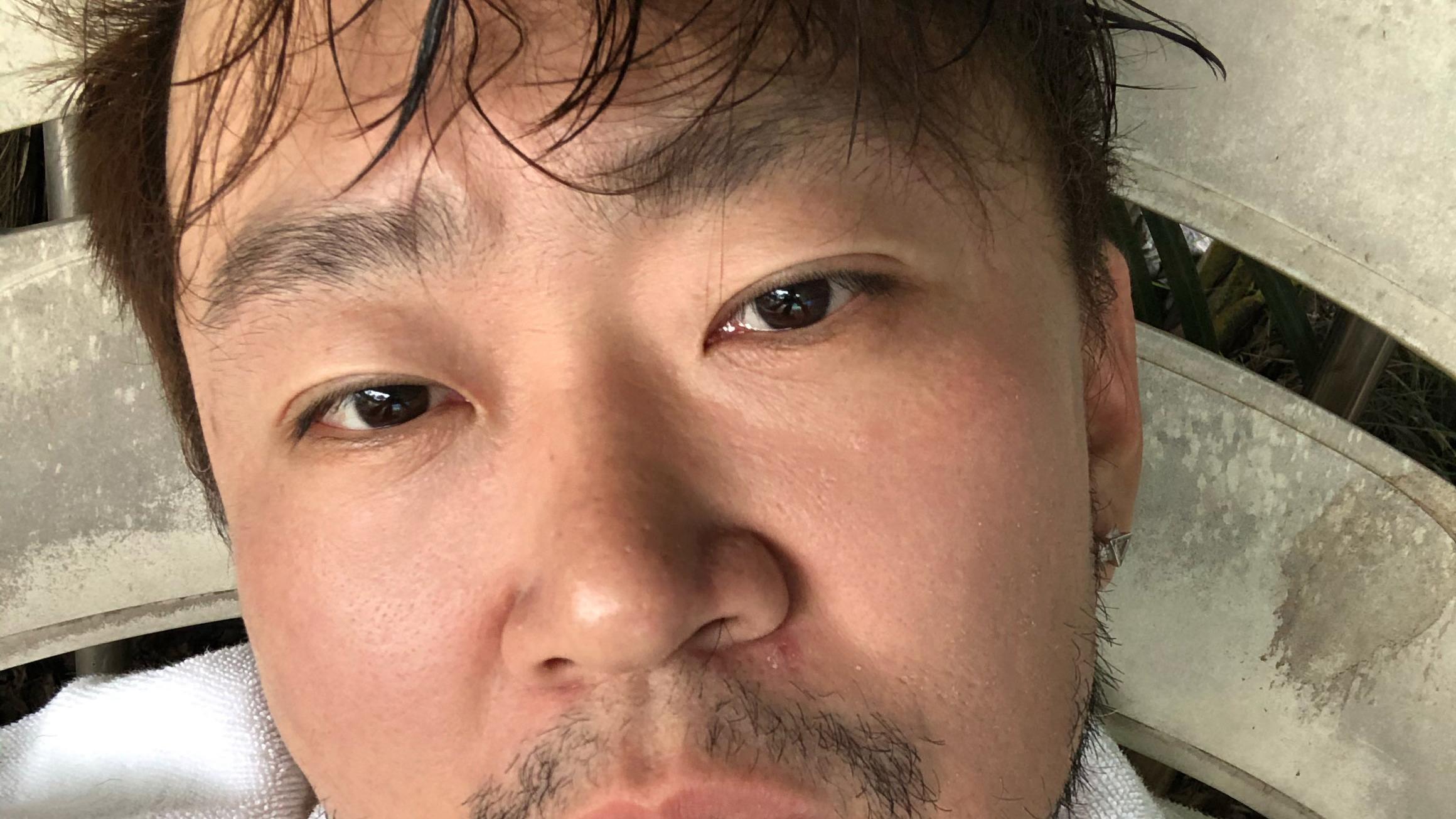 瘦身等于整容？更大于整容！