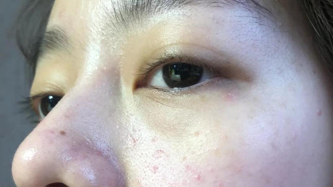 美容|皮肤白也不好？脸上的几个缺点很明显，你有吗