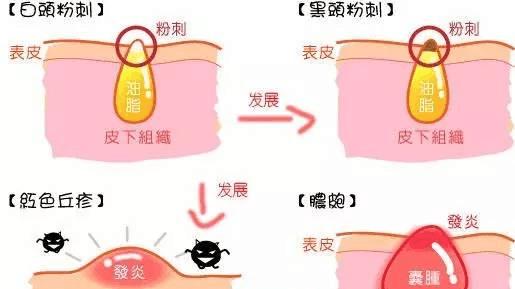 洗面奶 去油洗面奶好用吗 补水控油洗面奶推荐