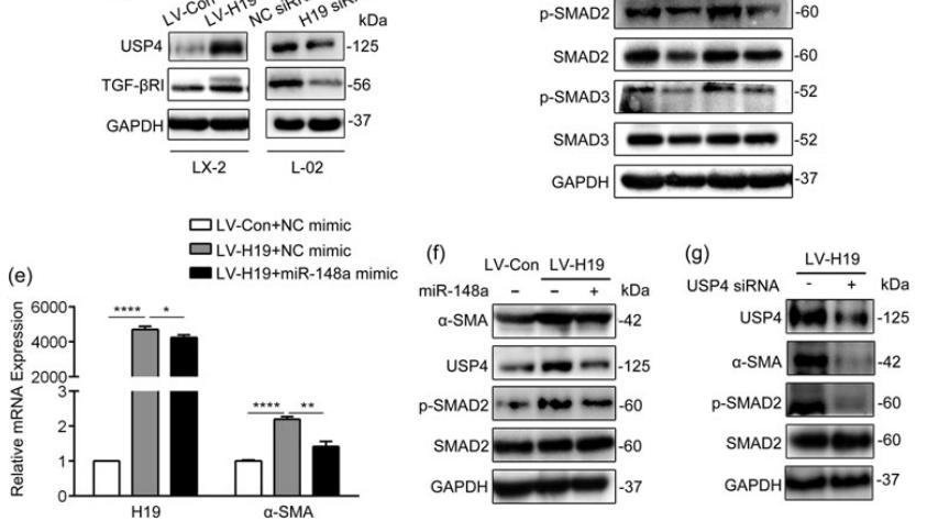 肝细胞 AbMole科研-H19/miR-148a/USP4轴增强肝星状细胞促进肝纤维化