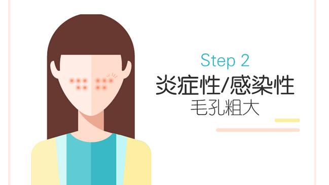 短发 美白淡斑哪个牌子好用 补水淡斑精华液排行榜