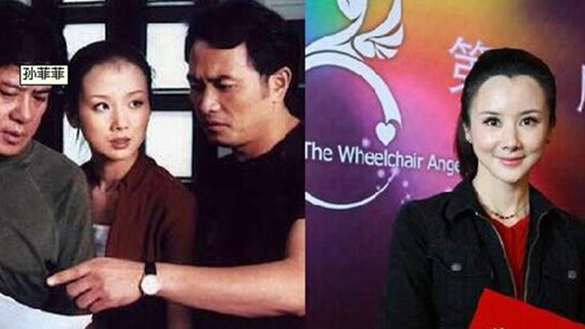 李小璐|被玻尿酸毁了的9位女星，李小璐的脸太假，而她如同“妖怪”