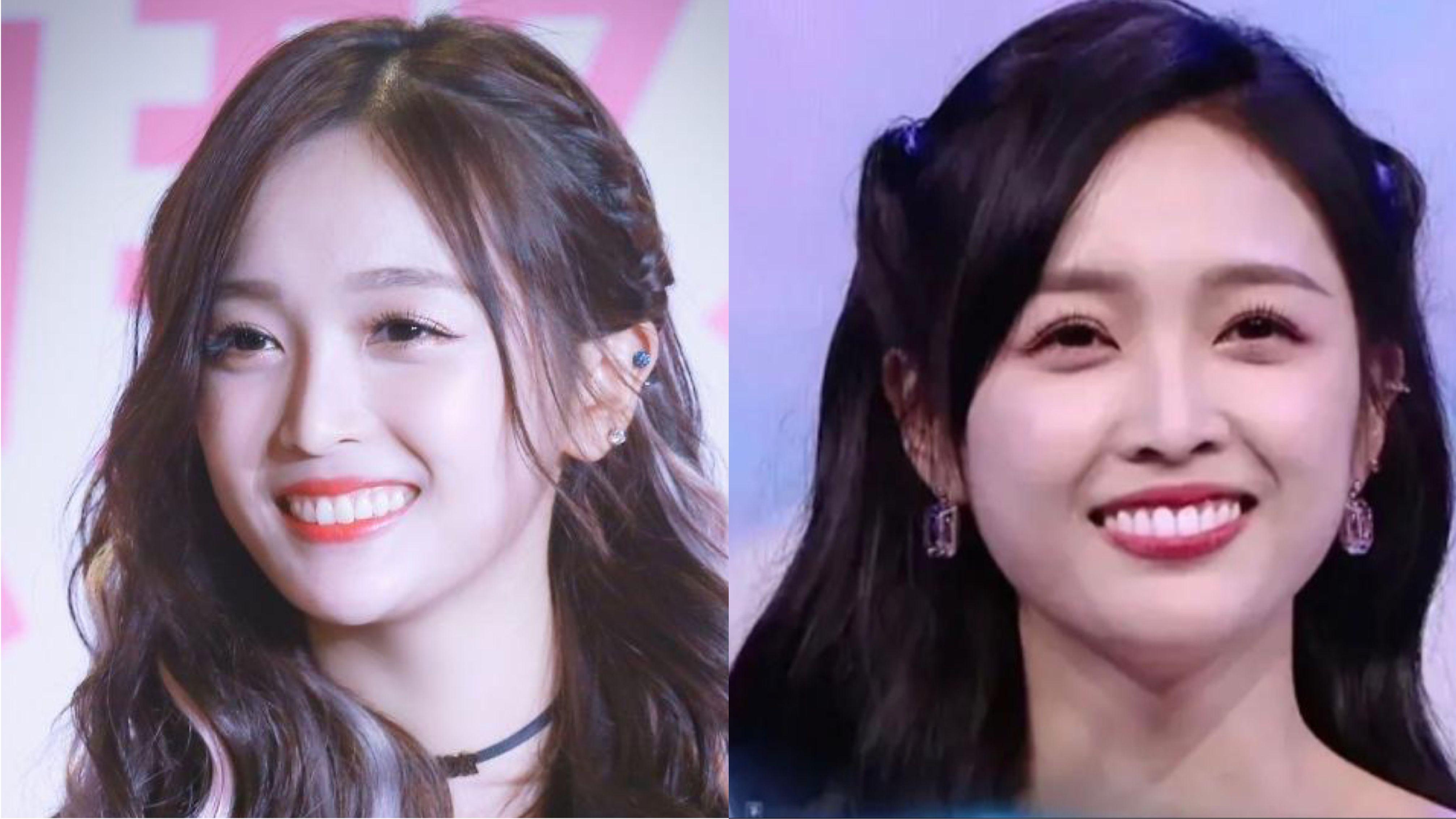 刘涛|这些明星做了烤瓷牙后，颜值反而下降了，连刘涛自己都后悔了！