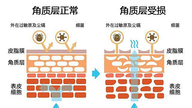 保湿|关于肌肤角质层受损的那些事儿——如何科学修复受损角质层？