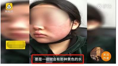 护肤品 怀孕不能用护肤品，会致畸？网友：怪不得这么早就被叫“阿姨”