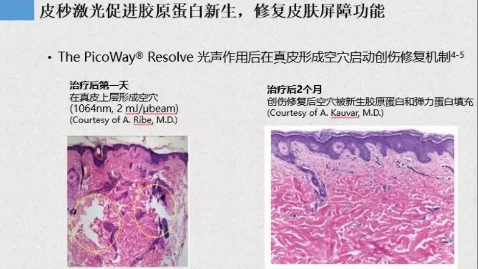 睡眠 淡斑一定能美白吗？你清楚它们的关系吗？