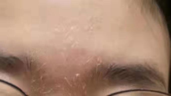 冬季护肤 冬季肌肤问题层出不穷？宝典在手，远离沙漠肌养成水光肌并不难！！