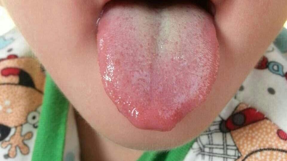 楚门妙手|孩子积食是个大问题，【整理】8个经典消食化积、健脾开胃的中成药，总有一个适合