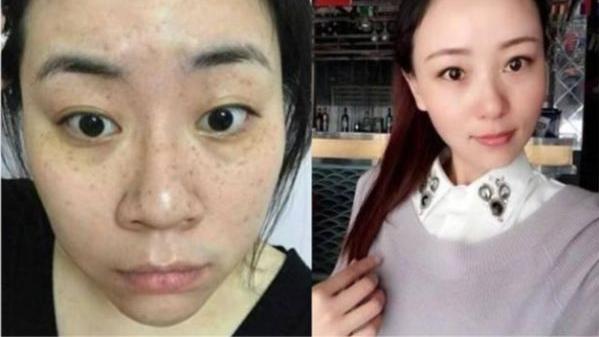 运动 国货“很牛”的精华霜，甩海蓝之谜一条街，却因便宜被忽视