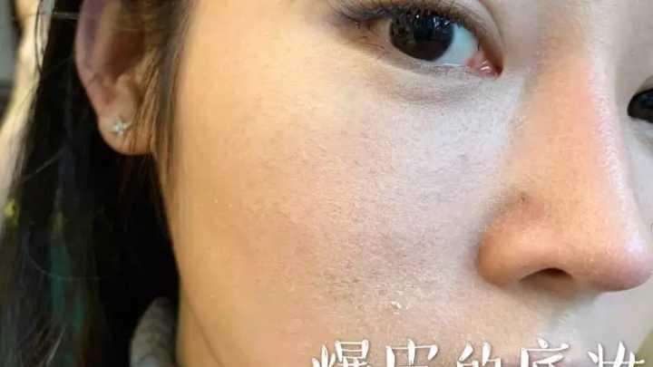 补水 若皮肤出现3个“信号”，证明你的皮肤需要补水了，中1个就得重视