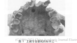 陕西长安区出土1000年前人牙齿形态的研究