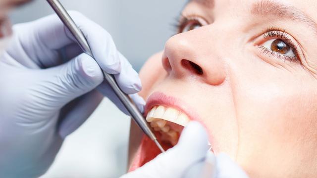 一口假牙能换一辆宝马，被贴暴利标签的种植牙，为何会如此贵？