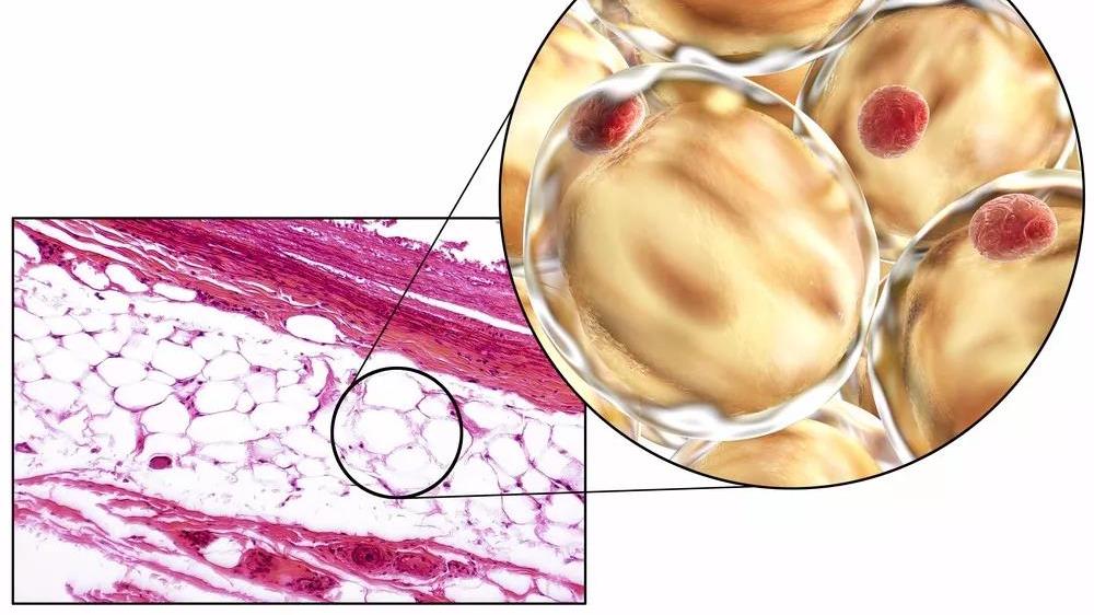 脐带 目前被广范应用的间充质干细胞是什么
