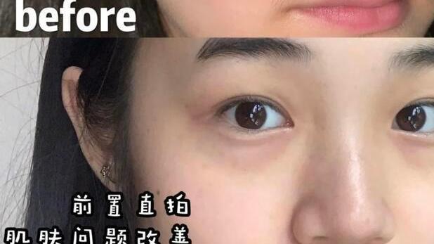 宋轶 32岁宋轶皮肤细腻无毛孔，大方分享护肤，自用“纯露”也意外走红