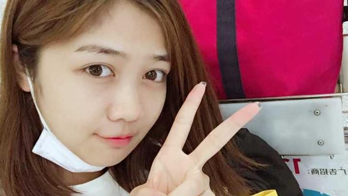美白 21岁女大学生长期浓妆，素颜时满脸黄褐斑，医生：皮肤太伤了