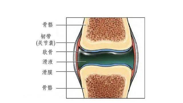 东鹤养生|膝盖痛滑膜炎？一点生姜一把葱，配合一个动作，赶走滑膜炎