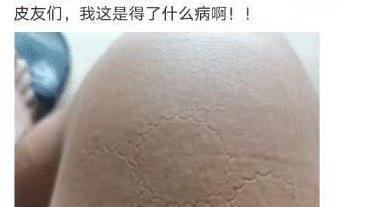 大家上卫生间时是喜欢蹲便器还是马桶呢？