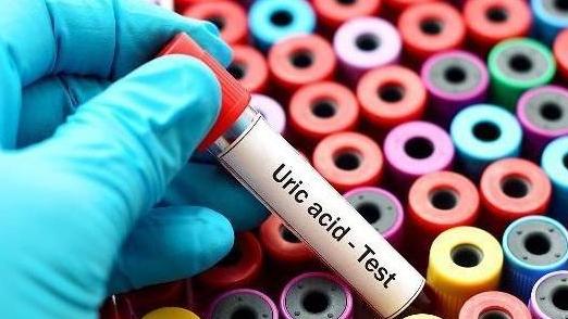 失眠|鱼肉是痛风的“发物”？提醒：尿酸高的人，这5物能不碰就不碰