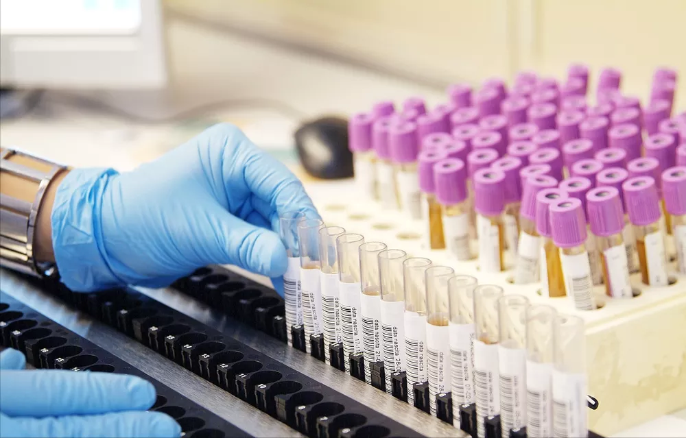 过敏|29岁男子发热，以为感冒，从入急诊到死亡仅1天，医生：被耽误了