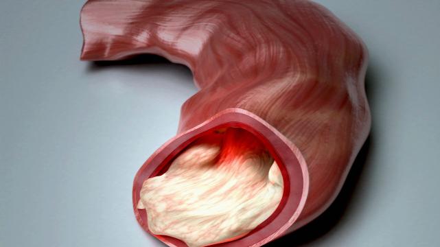 疾病预防|鸡蛋的胆固醇较高，中老年人不能吃吗？胆固醇偏高，该如何降低？