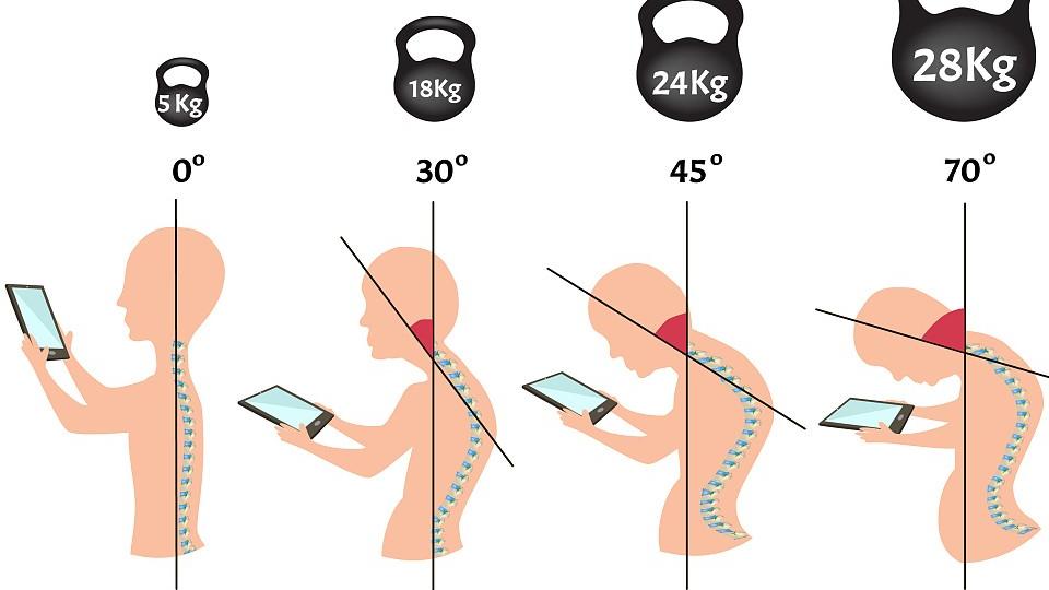 便秘|健康科普丨腰椎曲度变直，是好事还是坏事？