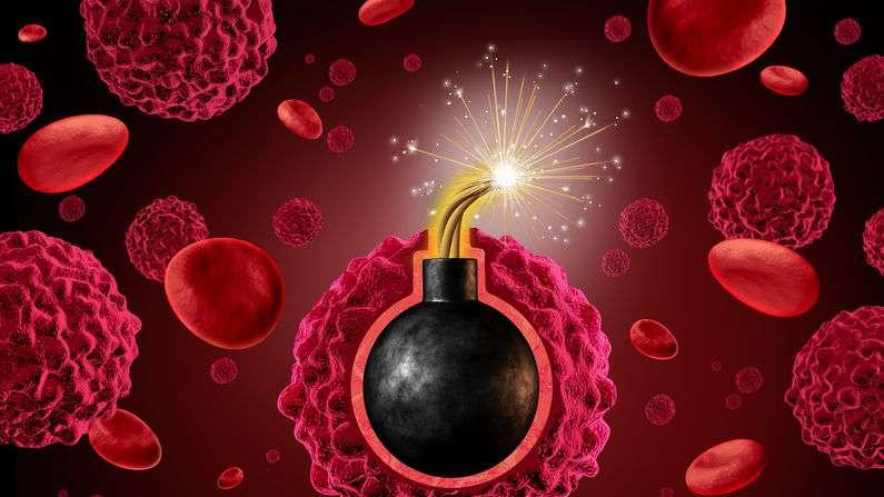 肾绞痛|男性符合这6个条件，或是癌症的高危人群，及时改掉，做好预防