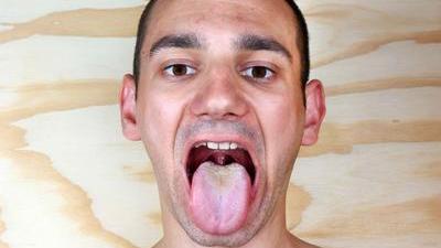 疾病|体内有疾，舌头先知，舌头出现这些变化时，说明健康出问题了