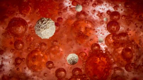 高血脂“根源”已找出，并非肥肉，医生：常吃“1酸”等于“自毁血管”