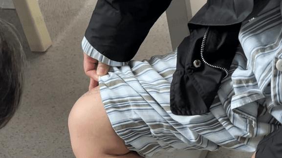 孕期|这种孕期落下的“丑”持续了10年，42岁的她终于摆脱了！