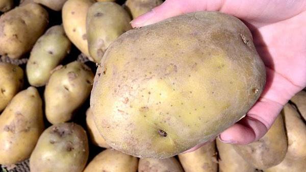 心脑血管疾病|心脑血管疾病患者，不注意这3点，心力衰竭可能就会找上你