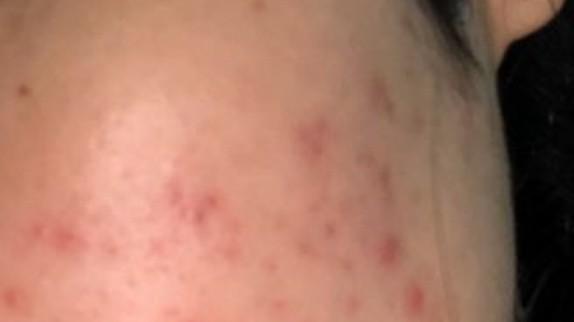 过敏|建议孕妈赶紧停止这些“无效护肤”，皮肤真的会变差，还过敏烂脸