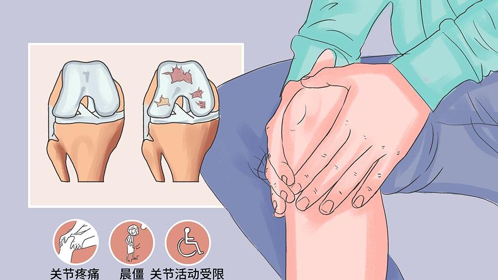 冠心病|早上起来晨僵，可能是这三种关节疾病之一