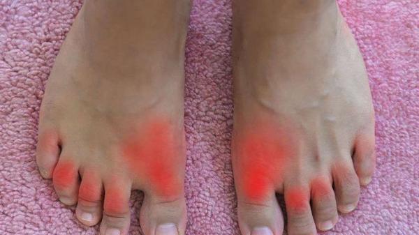 空腹|尿酸高的人，常吃这3种食物，有辅助降低尿酸的功效，不妨多吃