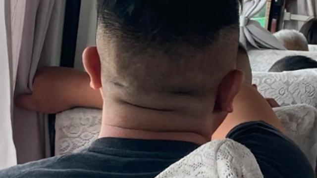 牛奶|身体太胖，可以看看一个地方，如果有一种变化，及时疏通一下